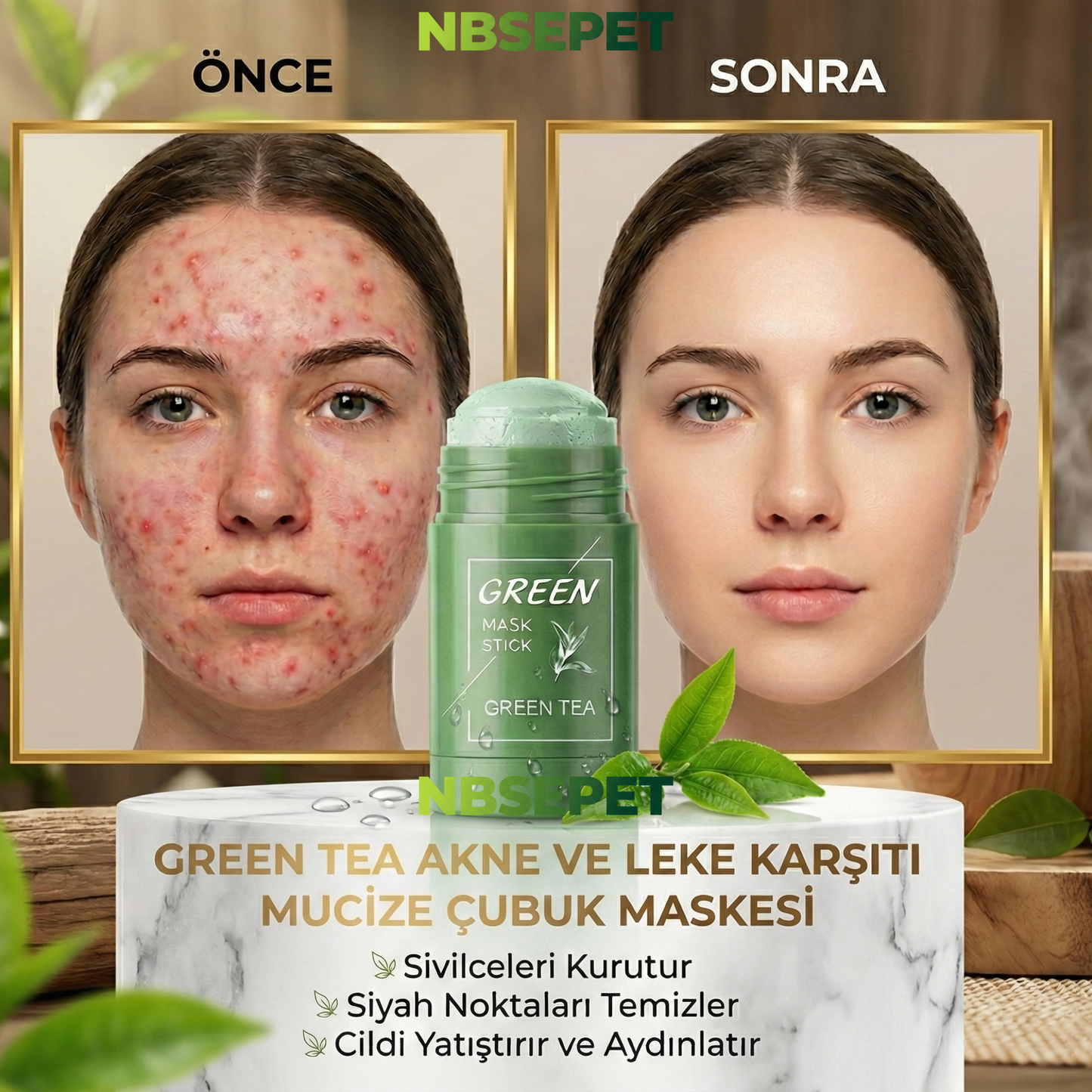 Yeşil Çay Özlü Siyah Nokta Ve Sivilce Maskesi